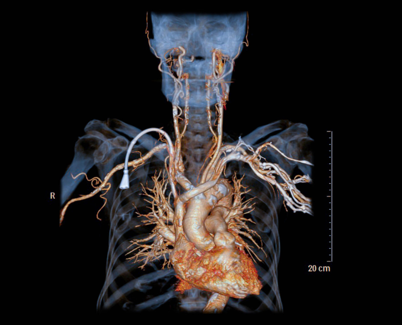 Meine OP Koronarangiographie klinikguide.at Gesundheit finden